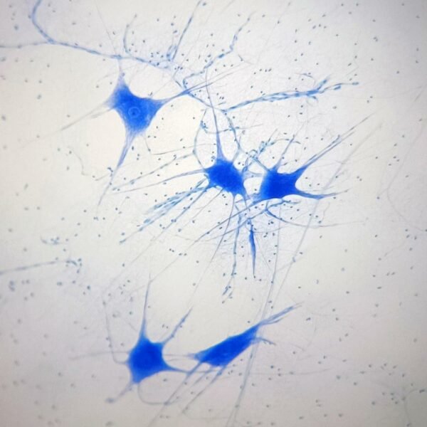 Νευρικό Κύτταρο (Μικροσκ.Παρασκεύασμα)